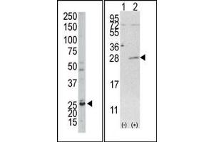 Image no. 1 for anti-Adenylate Kinase 4 (AK4) (C-Term) antibody (ABIN360619)