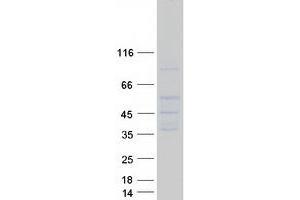 Image no. 1 for Solute Carrier Family 14 (Urea Transporter), Member 1 (Kidd Blood Group) (SLC14A1) (Transcript Variant 2) protein (Myc-DYKDDDDK Tag) (ABIN2732146)