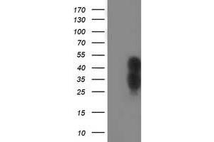 Image no. 2 for anti-WW Domain Containing Transcription Regulator 1 (WWTR1) antibody (ABIN2735651)