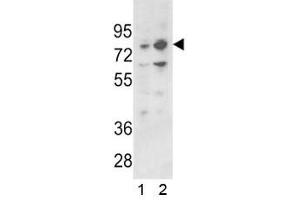 Image no. 2 for anti-Zinc Finger and BTB Domain Containing 16 (ZBTB16) (AA 637-666) antibody (ABIN3029667)