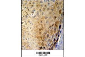 Image no. 2 for anti-Gasdermin A (GSDMA) (AA 66-94), (N-Term) antibody (ABIN651081)