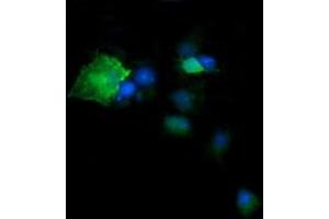 Image no. 4 for anti-Deleted in Primary Ciliary Dyskinesia Homolog (DPCD) antibody (ABIN1497889)