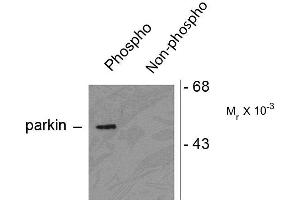 Image no. 1 for anti-Parkinson Protein 2, E3 Ubiquitin Protein Ligase (Parkin) (PARK2) (pSer378) antibody (ABIN361515)