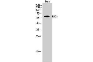 Image no. 1 for anti-Leucine-Rich alpha-2 Glycoprotein 1 (LRG1) (C-Term) antibody (ABIN3185409)