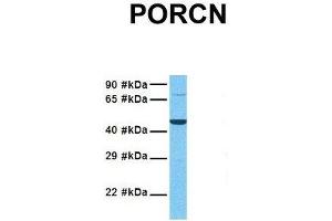 Image no. 4 for anti-Porcupine Homolog (PORCN) (N-Term) antibody (ABIN2783888)