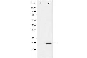 Image no. 4 for anti-Stathmin 1 (STMN1) (pSer38) antibody (ABIN6255270)