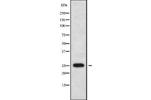 Image no. 2 for anti-Nucleolar Protein 12 (NOL12) (C-Term) antibody (ABIN6263684)