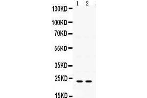 Image no. 1 for anti-Insulin-Like Growth Factor Binding Protein 5 (IGFBP5) (AA 76-114), (N-Term) antibody (ABIN3042733)