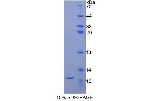 Image no. 1 for CD3d Molecule, delta (CD3-TCR Complex) (CD3D) protein (ABIN1170083)