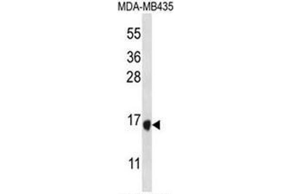 anti-Tachykinin 4 (TAC4) (AA 92-113), (C-Term) antibody