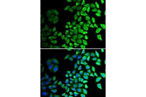 Image no. 1 for anti-Cell Division Cycle 45 Homolog (S. Cerevisiae) (CDC45) antibody (ABIN3022781)