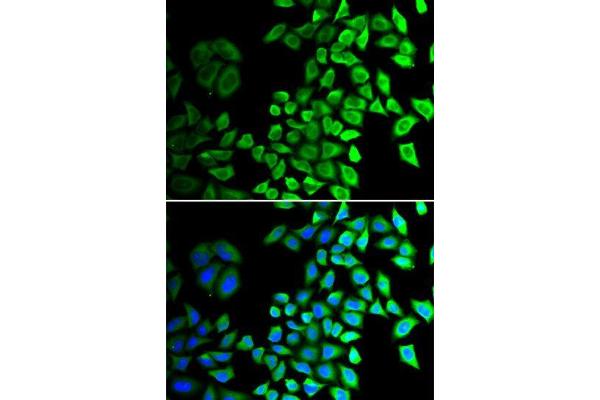 anti-Cell Division Cycle 45 Homolog (S. Cerevisiae) (CDC45) antibody