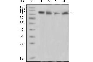 Image no. 2 for anti-PTK2B Protein tyrosine Kinase 2 beta (PTK2B) (AA 815-997) antibody (ABIN1724705)