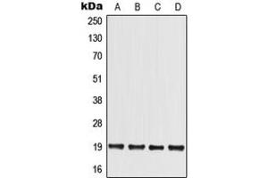 MED30 antibody  (Center)