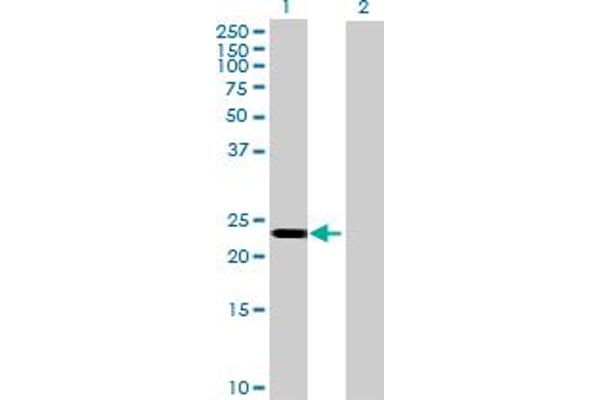 anti-Membrane-Spanning 4-Domains, Subfamily A, Member 12 (MS4A12) (AA 1-267) antibody