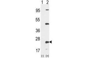 Image no. 1 for anti-Protein tyrosine Phosphatase Type IVA, Member 2 (PTP4A2) (Middle Region) antibody (ABIN453320)