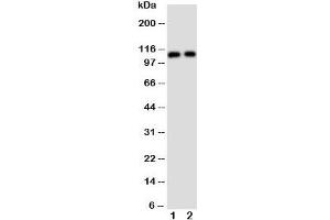Image no. 3 for anti-Transient Receptor Potential Cation Channel, Subfamily C, Member 6 (TRPC6) (Middle Region) antibody (ABIN3029233)