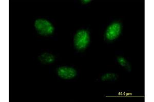 Image no. 2 for anti-V-Myb Myeloblastosis Viral Oncogene Homolog (Avian) (MYB) (AA 1-640) antibody (ABIN1327687)