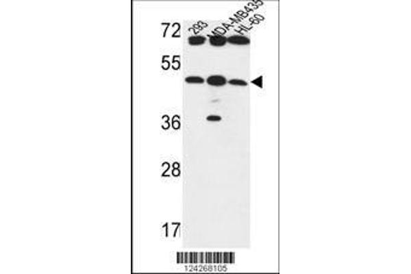 anti-UDP-GlcNAc:betaGal beta-1,3-N-Acetylglucosaminyltransferase 5 (B3GNT5) (AA 118-145) antibody