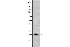 Image no. 1 for anti-Interleukin 26 (IL26) antibody (ABIN6262557)