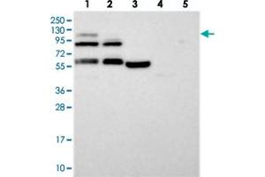 Image no. 2 for anti-N(alpha)-Acetyltransferase 25, NatB Auxiliary Subunit (NAA25) antibody (ABIN5649490)