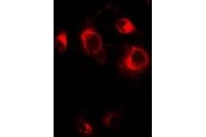 Image no. 1 for anti-Golgi Reassembly Stacking Protein 1, 65kDa (GORASP1) antibody (ABIN3198098)