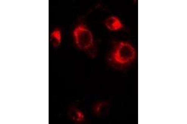 anti-Golgi Reassembly Stacking Protein 1, 65kDa (GORASP1) antibody