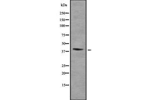 Image no. 1 for anti-Homeobox A2 (HOXA2) (Internal Region) antibody (ABIN6262340)