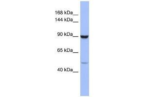 Image no. 1 for anti-Zinc Finger Protein 28 (ZFP28) (Middle Region) antibody (ABIN2781117)