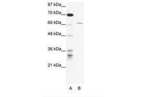 Image no. 1 for anti-IKAROS Family Zinc Finger 4 (Eos) (IKZF4) (AA 97-146) antibody (ABIN202738)