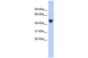 Image no. 1 for anti-Immediate Early Response 5-Like (IER5L) (C-Term) antibody (ABIN6743935)
