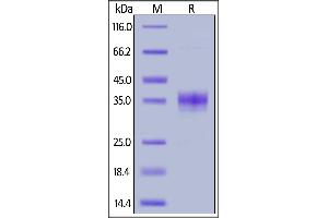 Image no. 2 for Sialic Acid Binding Ig-Like Lectin 15 (SIGLEC15) (AA 24-262) protein (His tag) (ABIN6809872)
