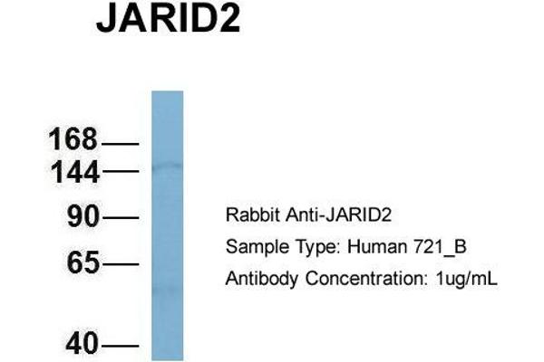 anti-Jumonji, AT Rich Interactive Domain 2 (JARID2) (N-Term) antibody