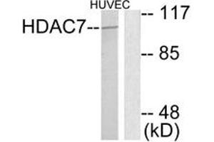 Image no. 1 for anti-Histone Deacetylase 7 (HDAC7) (AA 901-950) antibody (ABIN1533307)