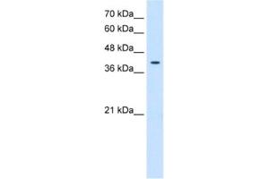 Image no. 1 for anti-Tetraspanin 12 (TSPAN12) antibody (ABIN2463028)