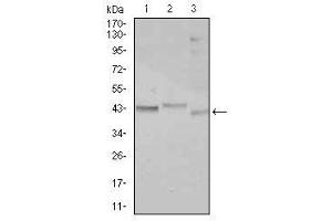 Image no. 5 for anti-CCAAT/enhancer Binding Protein (C/EBP), alpha (CEBPA) antibody (ABIN1497467)