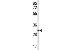 Image no. 4 for anti-CD40 Ligand (CD40LG) (AA 33-62) antibody (ABIN3028551)