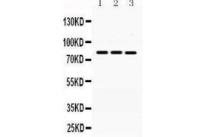 Image no. 3 for anti-Menage A Trois Homolog 1, Cyclin H Assembly Factor (Xenopus Laevis) (MNAT1) (AA 92-278) antibody (ABIN3043583)