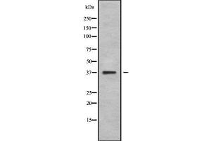 Image no. 1 for anti-Neurogenic Differentiation 4 (NEUROD4) (N-Term) antibody (ABIN6263610)