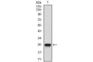 Image no. 3 for anti-5'-Nucleotidase, Ecto (CD73) (NT5E) (AA 30-250) antibody (ABIN1724945)