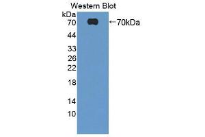 Image no. 2 for anti-Hyaluronan Binding Protein 2 (HABP2) (AA 24-560) antibody (ABIN1868316)