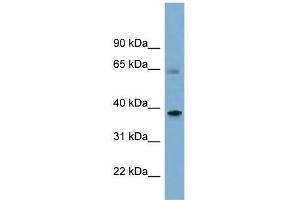 Image no. 1 for anti-Sorting Nexin 7 (SNX7) (Middle Region) antibody (ABIN634368)