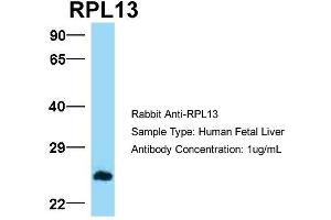Image no. 2 for anti-Ribosomal Protein L13 (RPL13) (C-Term) antibody (ABIN2778677)