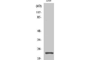 Western Blot analysis of A549 cells using Cleaved-PARP1 (D214) Polyclonal Antibody at dilution of 1:2000.