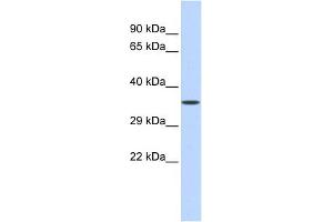 Image no. 1 for anti-Zinc Finger Protein 124 (ZNF124) (Middle Region) antibody (ABIN2780516)