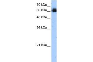 Image no. 1 for anti-V-Rel Reticuloendotheliosis Viral Oncogene Homolog B (RELB) (C-Term) antibody (ABIN2781334)