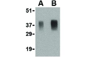 Image no. 2 for anti-Anterior Pharynx Defective 1 Homolog A (C. Elegans) (APH1A) (Internal Region) antibody (ABIN6656109)