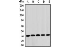 Image no. 2 for anti-serine/threonine Kinase 19 (STK19) antibody (ABIN2967072)