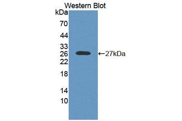 anti-5',3'-Nucleotidase, Mitochondrial (NT5M) (AA 30-209) antibody