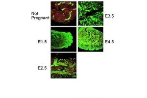PORCN antibody  (N-Term)
